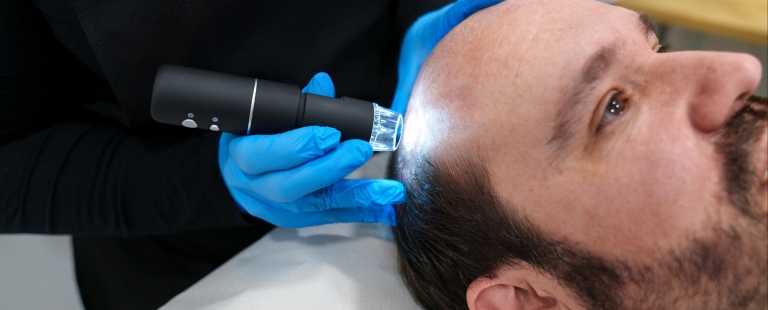 curso de tricologia para tratamentos capilares como alopécia