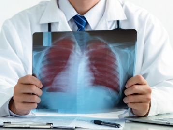 Curso em Doença Pulmonar Obstrutiva Crónica (DPOC)